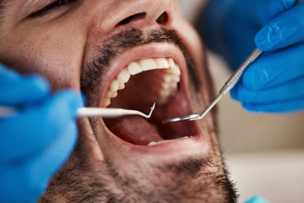 Tooth Infection Emergency Dentist in IA